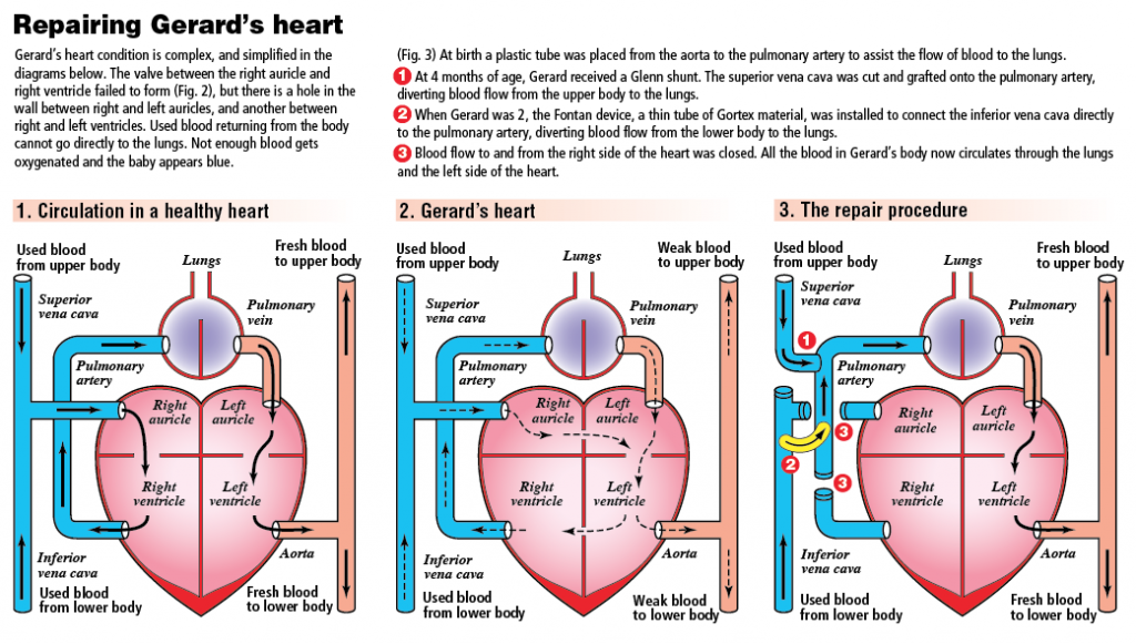 info-heart